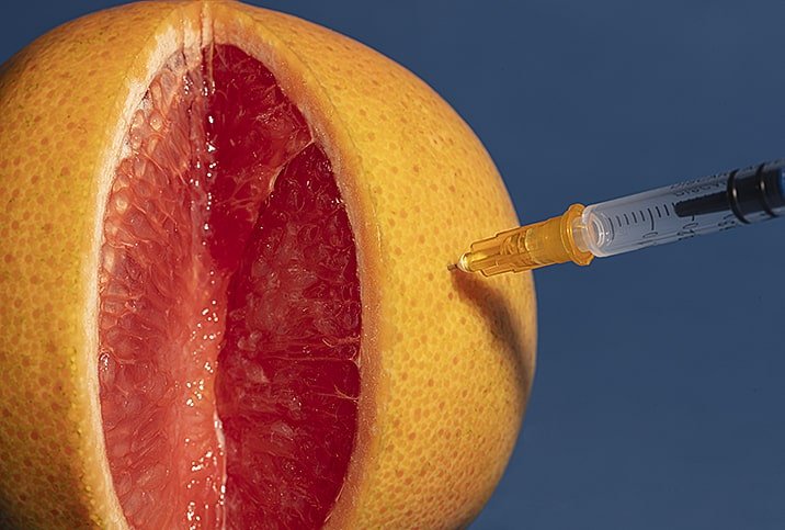 تکنیکهای غیر جراحی جوانسازی واژن توسط بهترین جراح زنان تهران