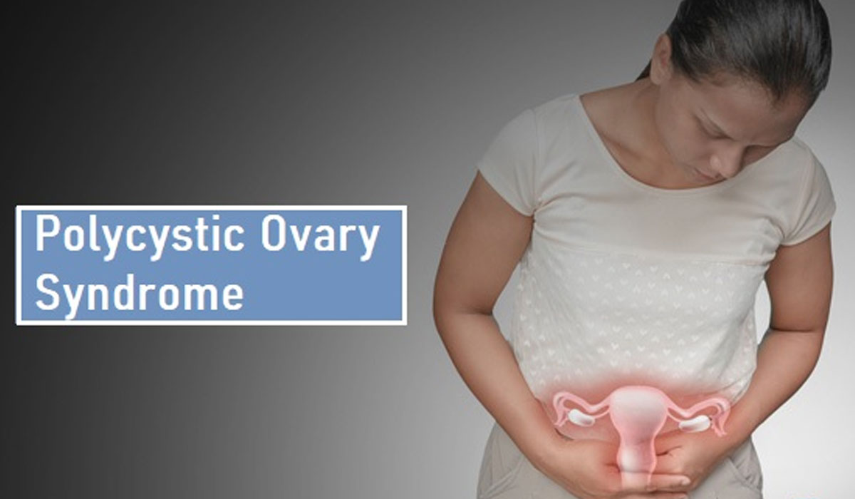 تنبلی تخمدان یا تخمدان پلی کیستیک