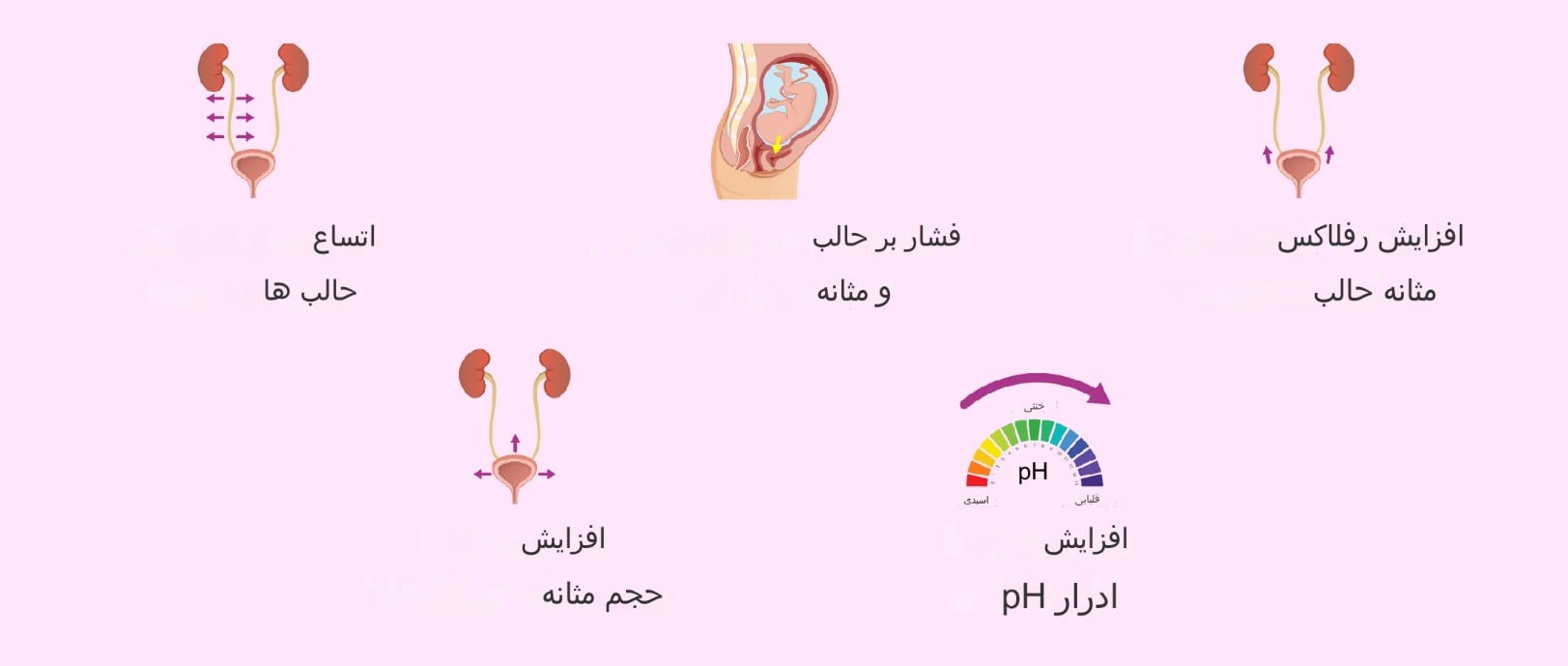 علل عفونت ادراری در بارداری
