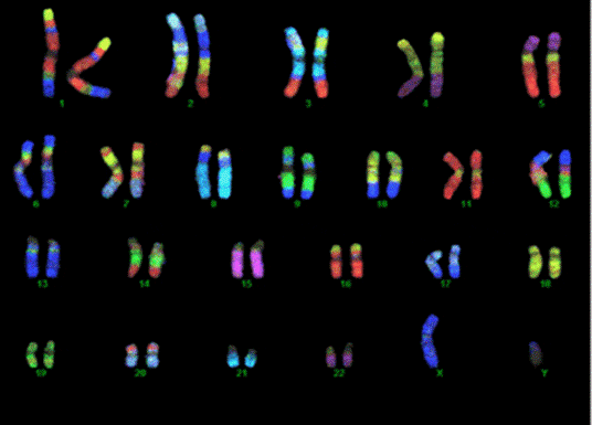 از دست دادن زودرس بارداری  