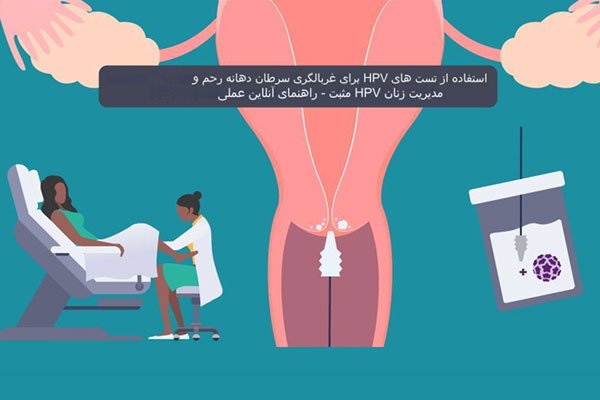 غربالگری ویروس پاپیلومای انسانی (HPV)