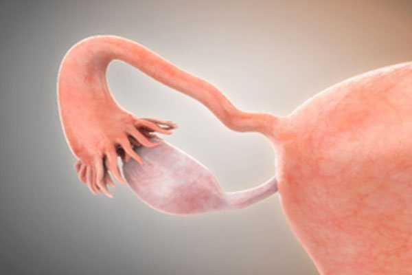 لوله های فالوپ