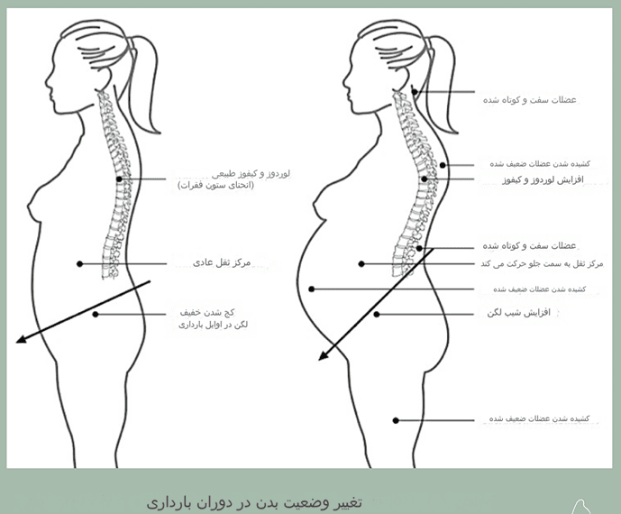 عضلات شکم و کمردرد بارداری