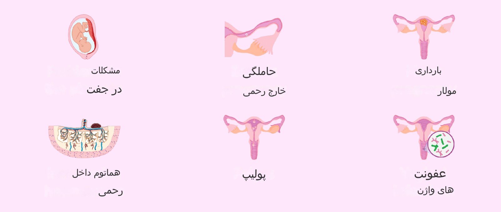 خونریزی واژینال در دوران بارداری 