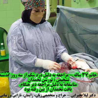 درمان تورشن تخمدان توسط دکتر زنان