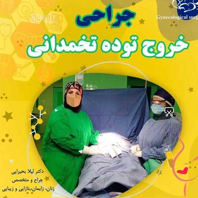 جراحی توده های تخمدانی