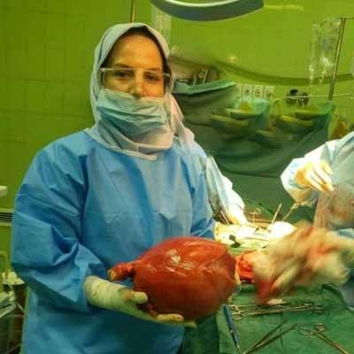 کیست و میوم خیلی خیلی بزرگ